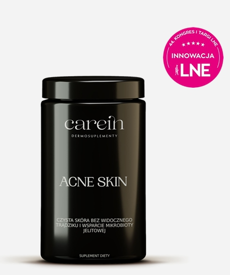 Acne Skin