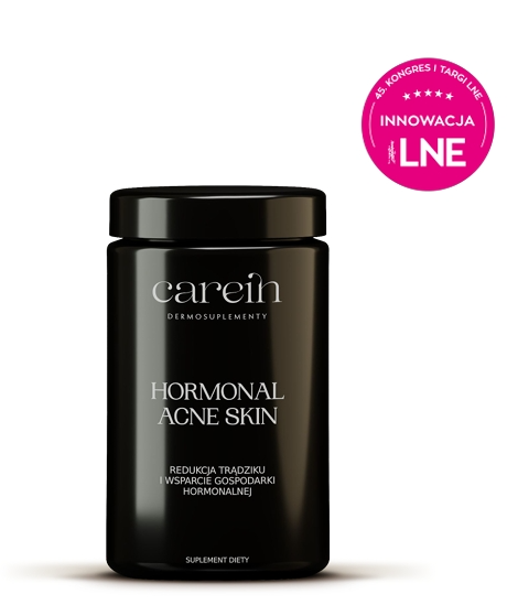 Hormonal Acne Skin